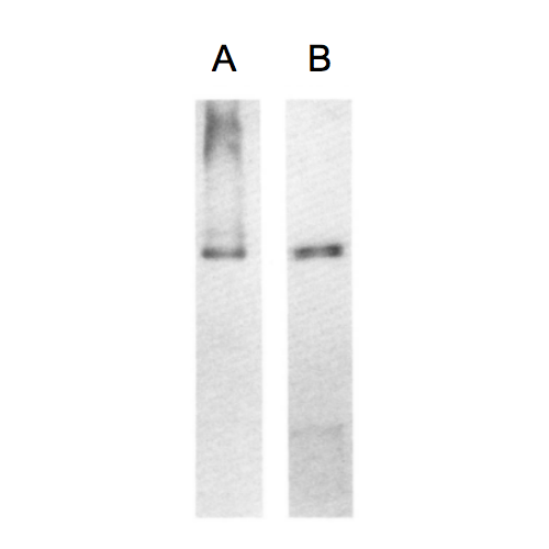High MW Kininogen Heavy Chain (2B5) antibody
