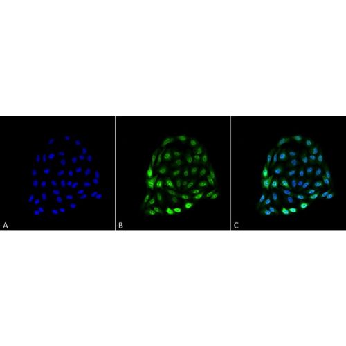 Hsp70 antibody (1.86)