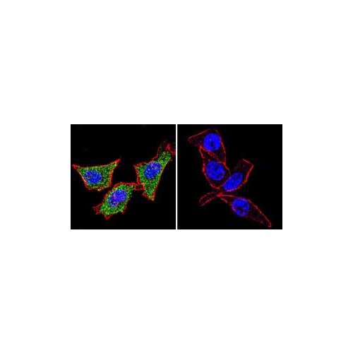 Hsp70 (5A5) antibody