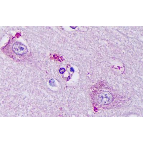 KCNQ2 K+ Channel (S26A-23) antibody