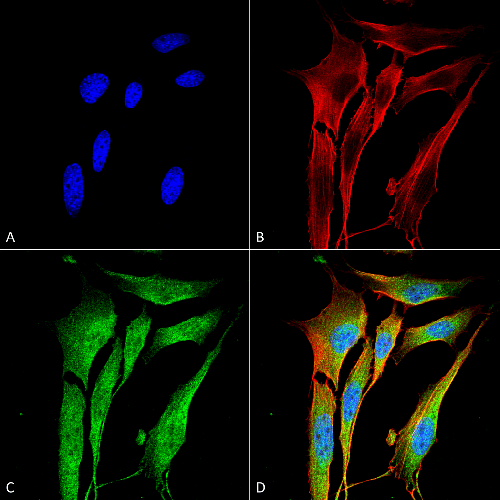 MMP9 (S51-82) antibody