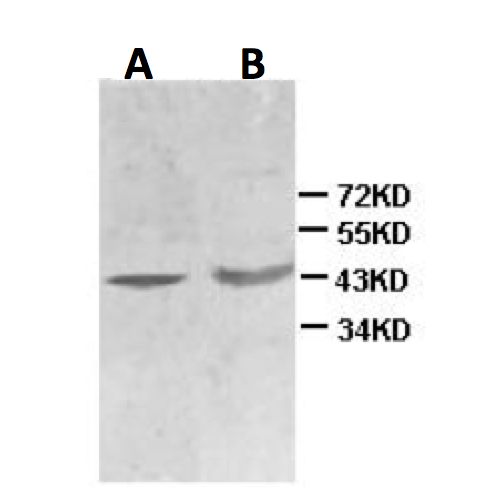 NALCN (S185-7) antibody