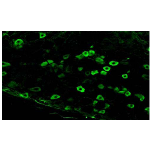 Nav1.8 Na+ Channel (S134-12) antibody