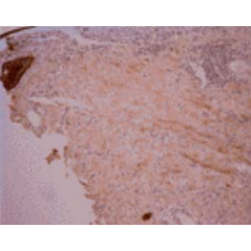 Osteocalcin (OCG2) antibody