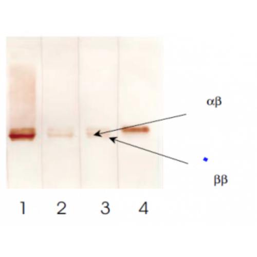 S100 alpha/beta (8B10) antibody