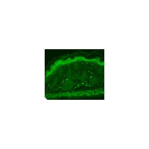 TrpV3 Cation Channel (S15-4) antibody