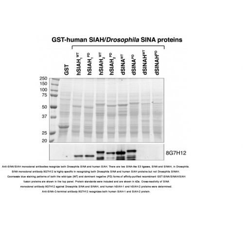 E3 ubiquitin-protein ligase SIAH1/2 antibody