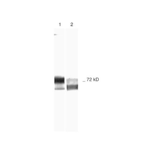 Matrix metalloproteinase-2 (MMP-2) antibody