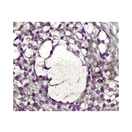 Matrix metalloproteinase-2 (MMP-2) antibody