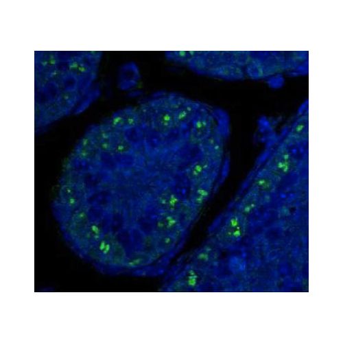 p19ARF antibody (5-C3-1)