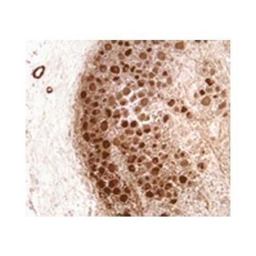 Neurofibromin antibody (McNFn27b)