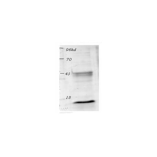 Acetylated Lysine antibody