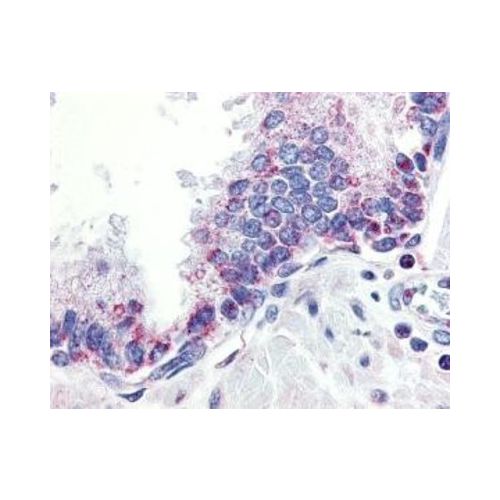 APRIL (Extracellular Domain 2) antibody