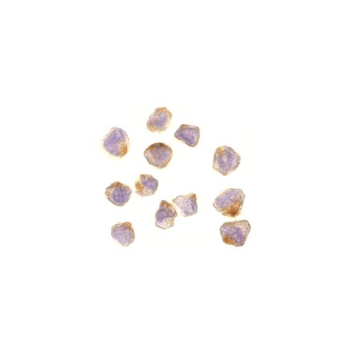 ASK1 (C-Terminus) antibody
