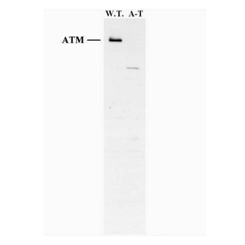 ATM antibody