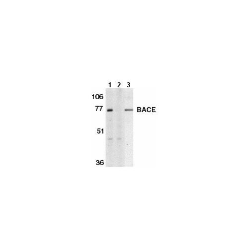 BACE (C-Terminus) antibody