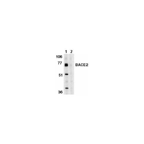 BACE2 (C-Terminus) antibody