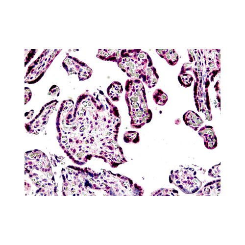 BACH1 antibody