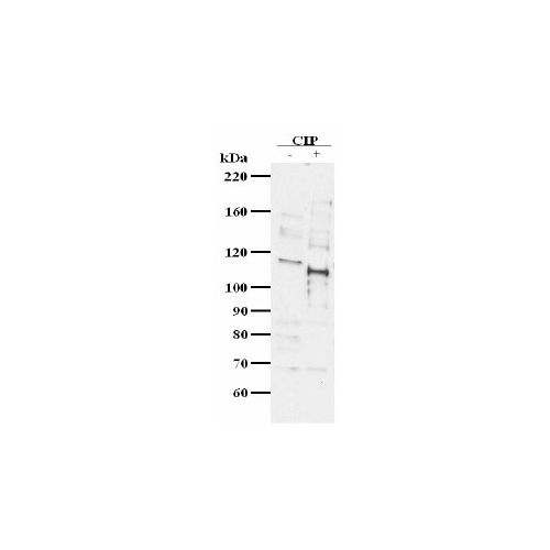 BRD2 antibody