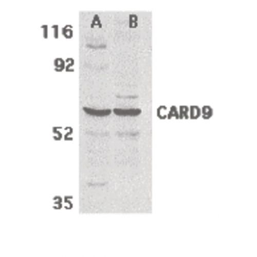 CARD9 antibody