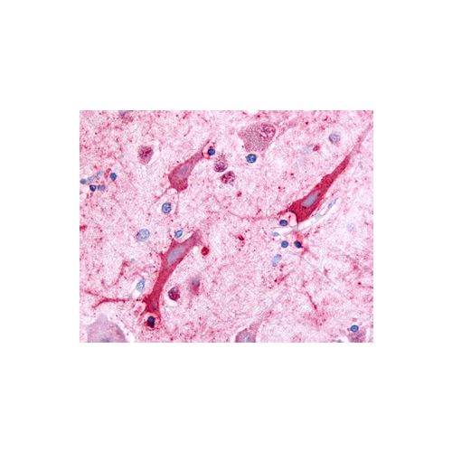 Ceramide Kinase antibody