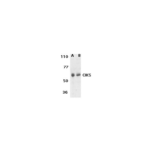 CIKS/Act1 (N-Terminus) antibody