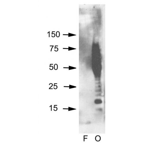 Amyloid Oligomer αβ antibody