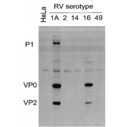 Rhinovirus 16 (R16-7) antibody