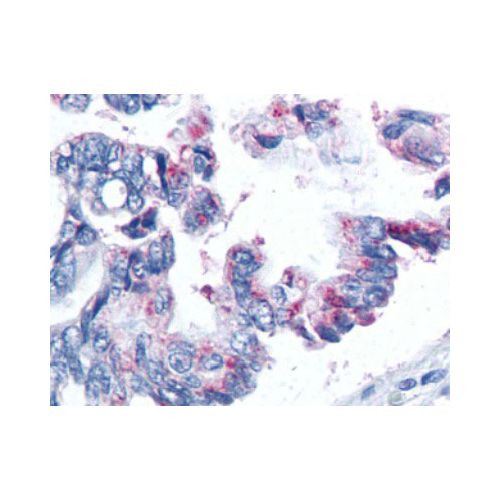 Survivin antibody (32.1)