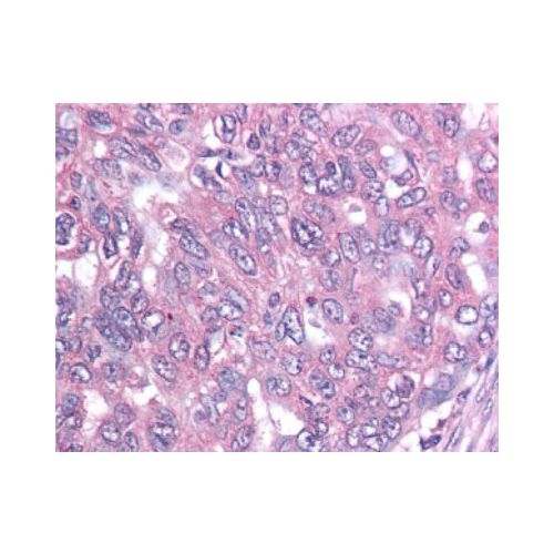 Survivin antibody (60.11)