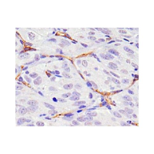 CD34 antibody (MEC 14.7)