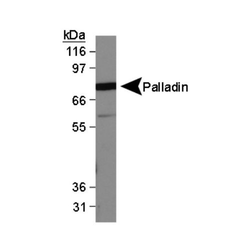 Palladin antibody (1E6)