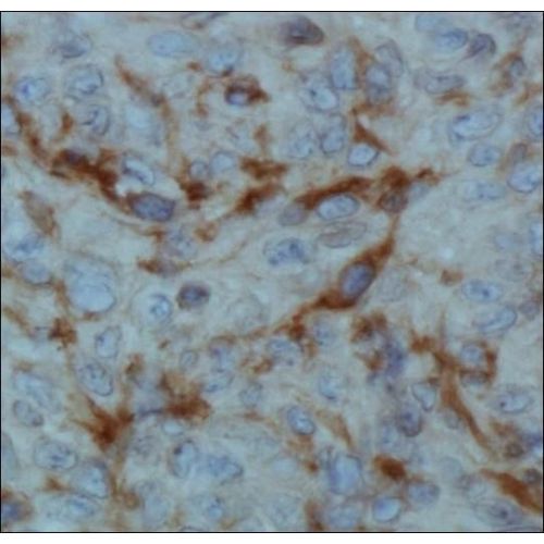 Hypoxia-inducible factor prolyl hydroxylase 2 antibody (366G/76/3)