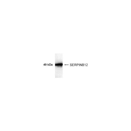 SERPINB12 antibody