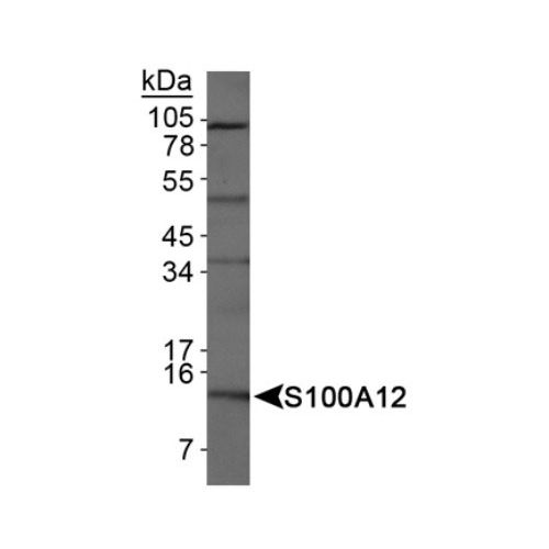 S100A12 antibody