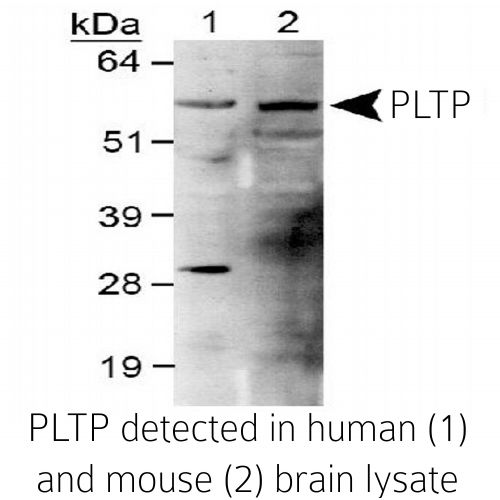 Phospholipid transfer protein (PLTP) antibody