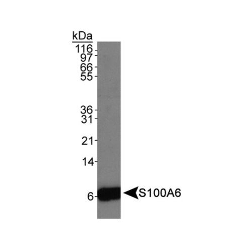 S100A6 antibody