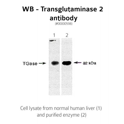 WB- Transglutaminase-2 antibody<br/>(pab0024-P)<br/>Anti-TG2 antibody WB staining of (1) normal human liver or (2) purified enzyme.