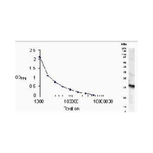 Presenilin 1 antibody
