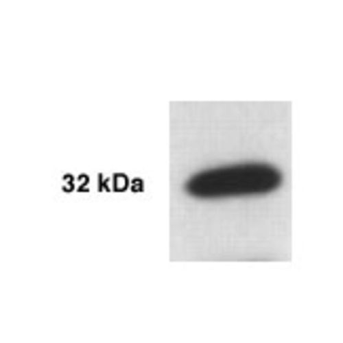 Kallikrein 5 antibody