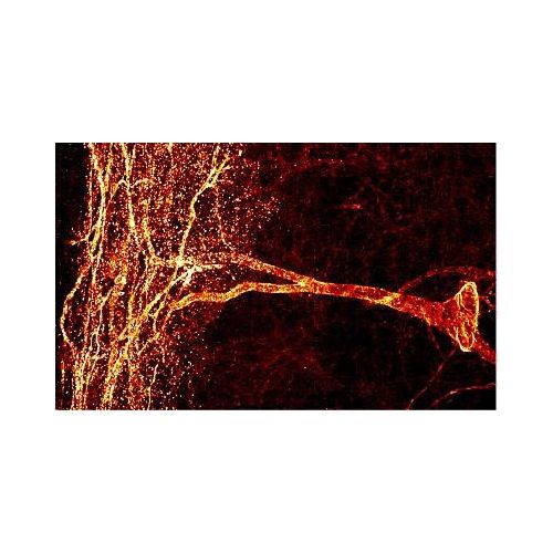 Neurokinin 1 Receptor (NK-1R) antibody