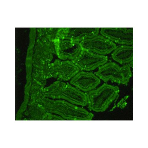 Somatostatin Receptor 2 antibody