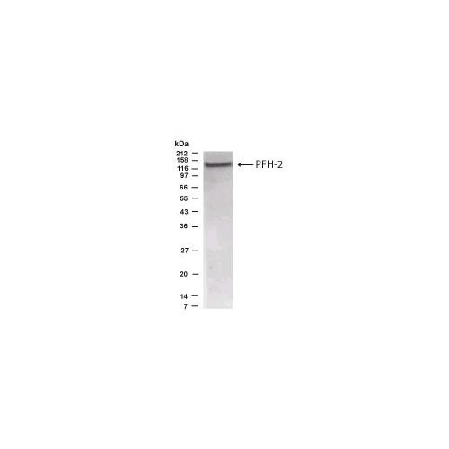 PHF2 antibody