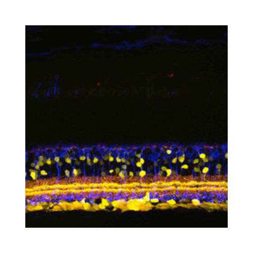 SHANK1a antibody