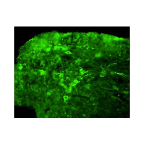 Neurokinin B antibody