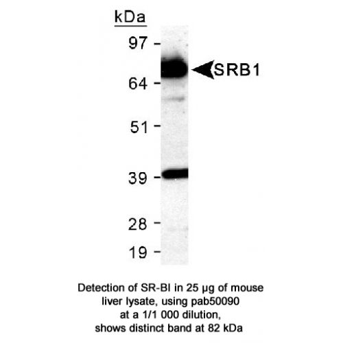 SR-BI antibody