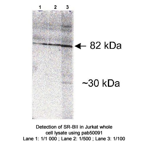 SR-BII antibody