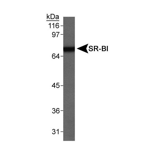 SR-BI antibody