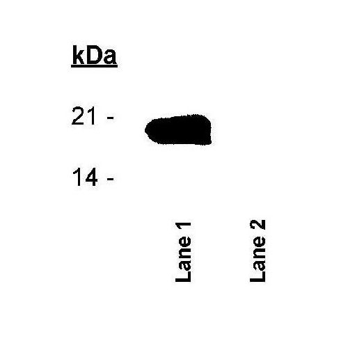 Survivin [p Thr34] antibody