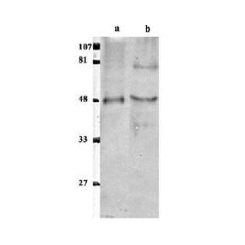 ETS1 associated protein II antibody
